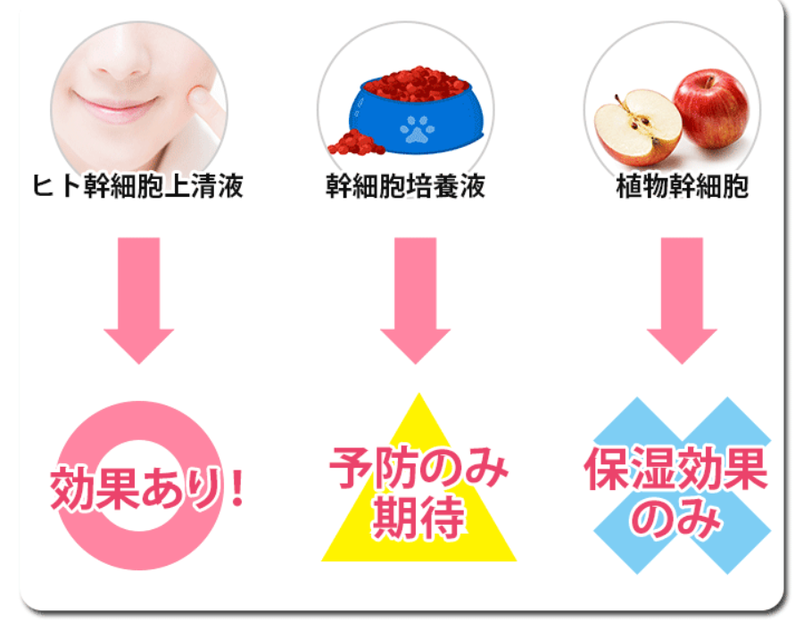 Stemcell hikaku